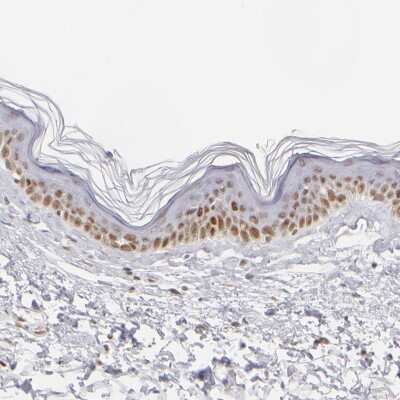 Immunohistochemistry-Paraffin: TFAP4 Antibody [NBP1-89060]
