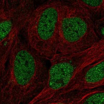 Immunocytochemistry/ Immunofluorescence: TFCP2 Antibody [NBP2-55972]