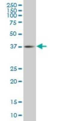 Western Blot: TFDP3 Antibody (3F11) [H00051270-M02]