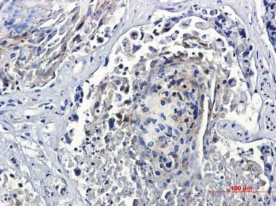 Immunohistochemistry: TFEB Antibody (S05-0D7) [NBP3-14901]