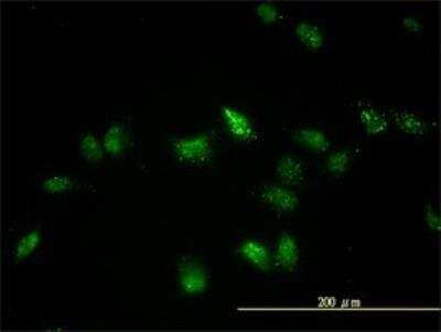 Immunocytochemistry/ Immunofluorescence: TFEB Antibody (S1) [H00007942-M01]