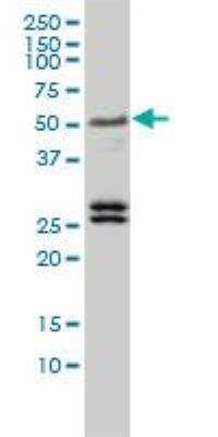 Western Blot: TFEB Antibody (S1) [H00007942-M01]
