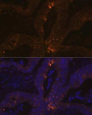 Immunohistochemistry: TFF1/pS2 Antibody (6P6R7) [NBP3-16651]