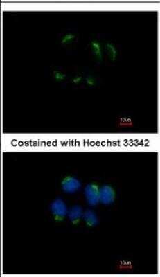 Immunocytochemistry/ Immunofluorescence: TFF1/pS2 Antibody [NBP2-16376]