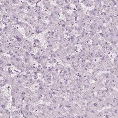 Immunohistochemistry-Paraffin: TFF1/pS2 Antibody [NBP1-90813]