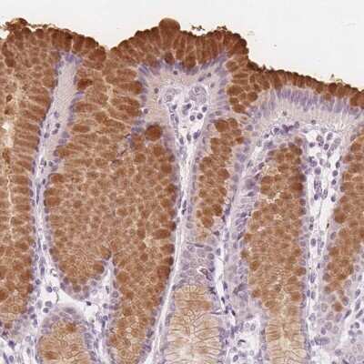 Immunohistochemistry-Paraffin: TFF1/pS2 Antibody [NBP1-90813]