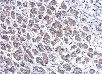 Immunohistochemistry-Paraffin: TFF1/pS2 Antibody [NBP2-16376]