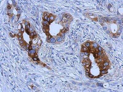 Immunohistochemistry-Paraffin: TFF1/pS2 Antibody [NBP2-16376]