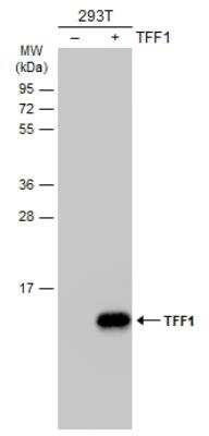 Western Blot: TFF1/pS2 Antibody [NBP2-16376]