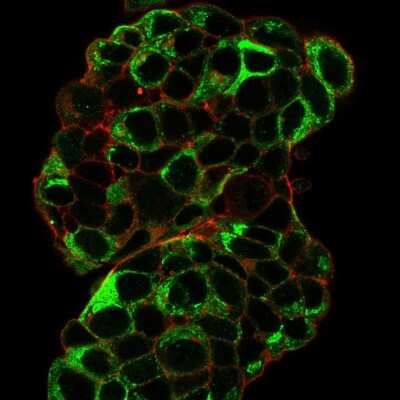 Immunocytochemistry/ Immunofluorescence: TFF1/pS2 Antibody (TFF1/2133) - Azide and BSA Free [NBP3-08247]