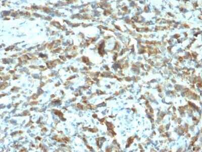 Immunohistochemistry-Paraffin: TFF1/pS2 Antibody (TFF1/2133) [NBP3-07341]