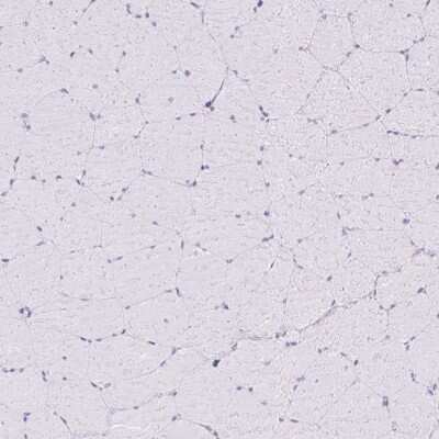 Immunohistochemistry-Paraffin: TFF2 Antibody [NBP2-34032]