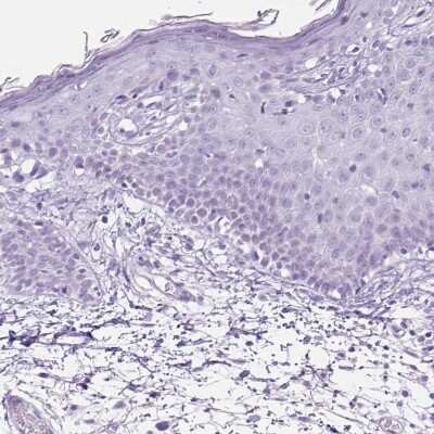 Immunohistochemistry-Paraffin: TFF2 Antibody [NBP2-34032]