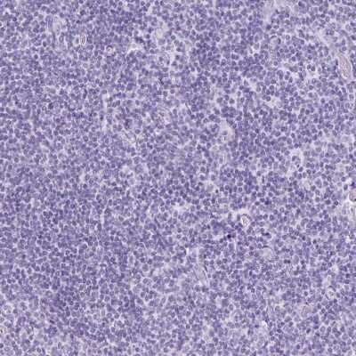 Immunohistochemistry-Paraffin: TFF2 Antibody [NBP2-34032]