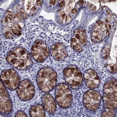 Immunohistochemistry-Paraffin: TFF3 Antibody [NBP2-34007]