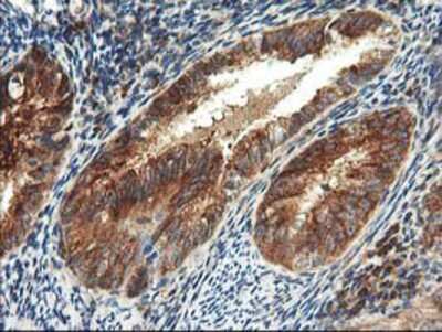 Immunohistochemistry-Paraffin: TFG Antibody (OTI2C3) [NBP2-01438]