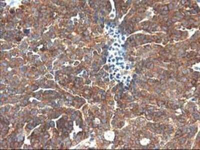 Immunohistochemistry-Paraffin: TFG Antibody (OTI2C3) [NBP2-01438]