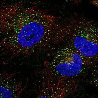 Immunocytochemistry/ Immunofluorescence: TFG Antibody [NBP2-56681]