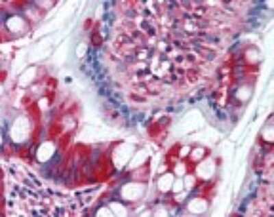 Immunohistochemistry-Paraffin: TFG Antibody [NBP2-24485]
