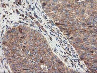 Immunohistochemistry: TFG Antibody (OTI2C3) - Azide and BSA Free [NBP2-74491]