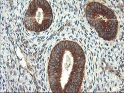 Immunohistochemistry: TFG Antibody (OTI2C3) - Azide and BSA Free [NBP2-74491]