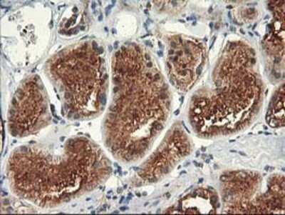 Immunohistochemistry: TFG Antibody (OTI2C3) - Azide and BSA Free [NBP2-74491]