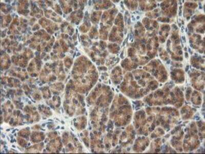 Immunohistochemistry: TFG Antibody (OTI2C3) - Azide and BSA Free [NBP2-74491]