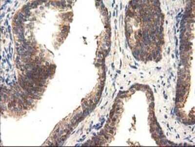 Immunohistochemistry: TFG Antibody (OTI2C3) - Azide and BSA Free [NBP2-74491]