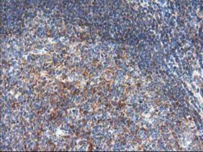 Immunohistochemistry: TFG Antibody (OTI2C3) - Azide and BSA Free [NBP2-74491]