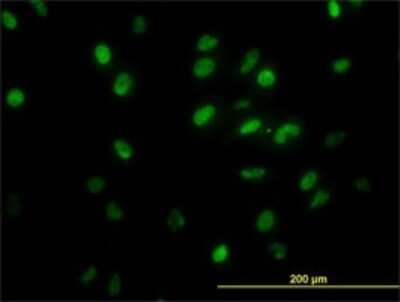 Immunocytochemistry/ Immunofluorescence: TFII-I Antibody (2D6) [H00002969-M02]