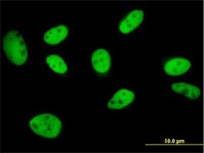 Immunocytochemistry/ Immunofluorescence: TFII-I Antibody (3E2) [H00002969-M01]