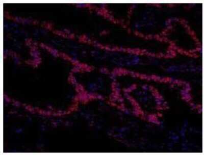 Immunocytochemistry/ Immunofluorescence: TFII-I Antibody [NB100-61054]