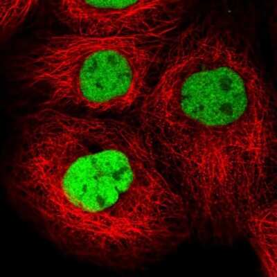 Immunocytochemistry/ Immunofluorescence: TFII-I Antibody [NBP1-90010]