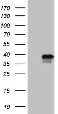 Western Blot: TFIIB Antibody (OTI1H10) [NBP2-45929]