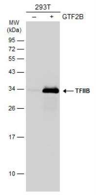 Western Blot: TFIIB Antibody [NBP1-32622]