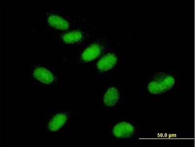 Immunocytochemistry/ Immunofluorescence: TFIIE-alpha Antibody [H00002960-B01P]