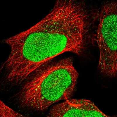 Immunocytochemistry/ Immunofluorescence: TFIIE beta Antibody [NBP1-87931]