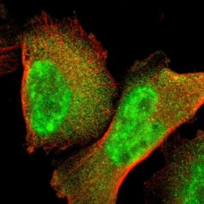 Immunocytochemistry/ Immunofluorescence: TFIIE beta Antibody [NBP2-55117]