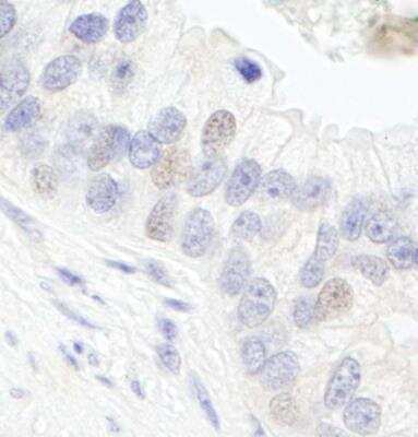 Immunohistochemistry-Paraffin: TFIIIC Antibody [NB100-60657]