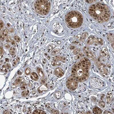 Immunohistochemistry-Paraffin: TFIIIC Antibody [NBP2-14077]