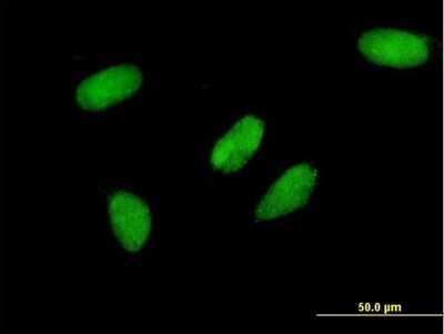 Immunocytochemistry/ Immunofluorescence: TFIISH Antibody (2C9) [H00006920-M06]
