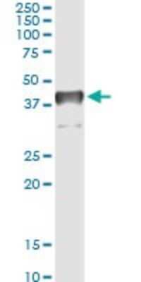 Immunoprecipitation: TFIISH Antibody (2C9) [H00006920-M06]