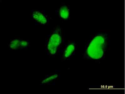 Immunocytochemistry/ Immunofluorescence: TFIISH Antibody (3B9) [H00006920-M07]