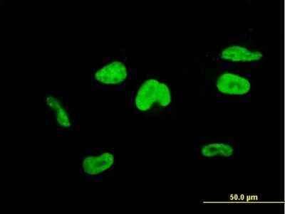 Immunocytochemistry/ Immunofluorescence: TFIISH Antibody (4E11) [H00006920-M08]