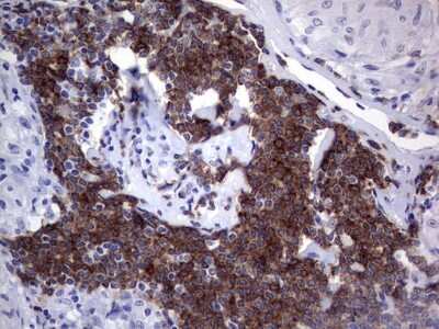 Immunohistochemistry: TFPI-2 Antibody (OTI1D4) [NBP2-46100]