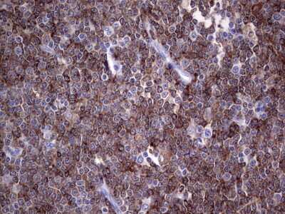 Immunohistochemistry: TFPI-2 Antibody (OTI1D4) [NBP2-46100]