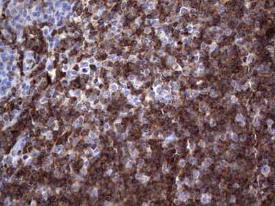 Immunohistochemistry: TFPI-2 Antibody (OTI1D4) [NBP2-46100]
