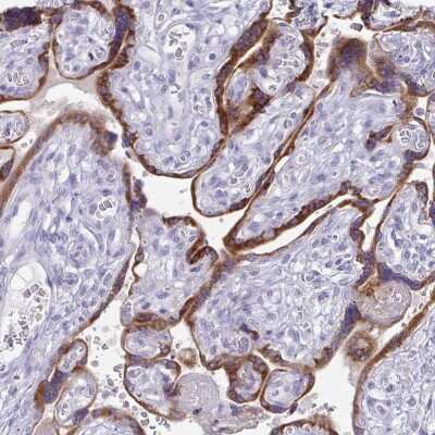 Immunohistochemistry-Paraffin: TFPI-2 Antibody [NBP2-33552]