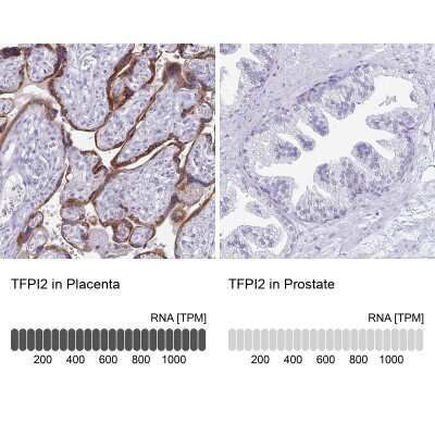 Immunohistochemistry-Paraffin: TFPI-2 Antibody [NBP2-33552]