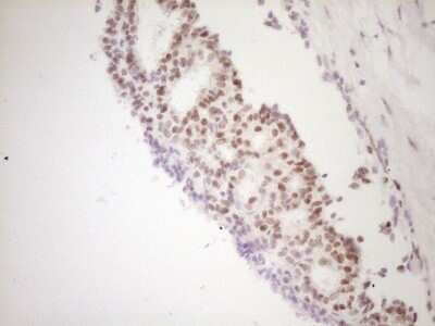 Immunohistochemistry: TFPI Antibody (OTI5H5) [NBP2-46098]